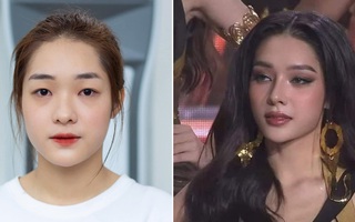 Ảnh trước phẫu thuật thẩm mỹ của Miss Grand Thái Bình 'gây bão'
