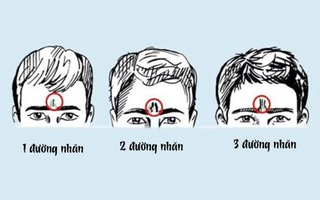 Đường nhăn trán tiết lộ gì về bạn?