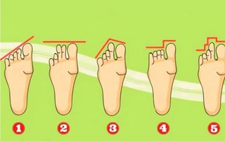 Hình dạng bàn chân bộc lộ tính cách của bạn