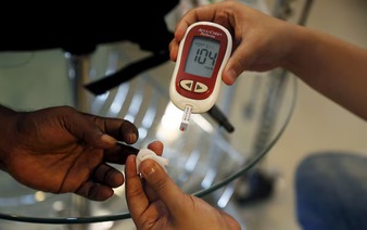 Japan team develops AI model to detect diabetes risk with ECG data