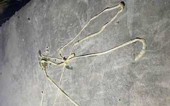 Nearly-10-meter pork tapeworm found parasitizing man in Vietnam