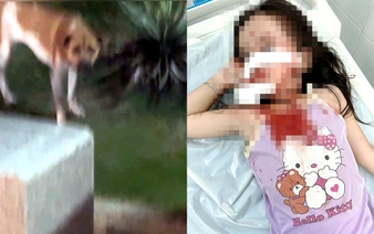 4-year-old girl mauled by loose dog at coastal square in Ho Chi Minh City