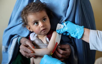 UN warns 200,000 more Afghan children face acute malnutrition in 2026