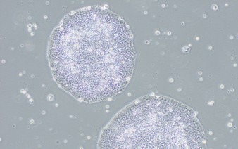 Japan oks world's 1st iPS cell treatments