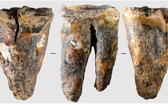 Tooth from Siberian cave reveals Neanderthal dental surgery