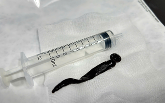 In Vietnam, doctors find 12cm leech living in 8-year-old boy’s airway