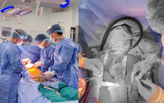 Vietnam performs 1st successful implantation of compact mechanical heart pump