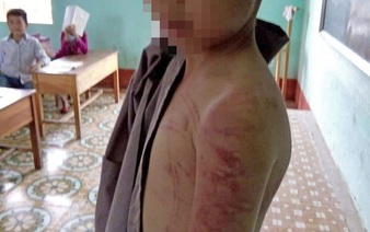 10-yo boy allegedly beaten by abbot in north-central Vietnam