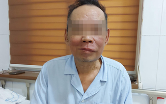 Vietnamese man suffers facial disfigurement from oral cancer as pandemic delays hospital visit