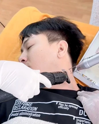 Hoài Lâm xóa sạch hình xăm