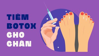 Chân xấu, tiêm botox được không?