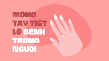 Móng tay tiết lộ bệnh trong người?