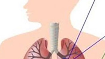 Bỏ thuốc lá để không gia nhập vào số 10 người chết/giây vì COPD!