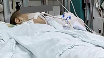Cấp cứu trẻ 13 tháng tuổi vì uống nhầm dầu thắp đèn