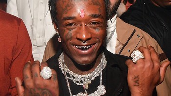 Rapper Dan Sur trông thế nào trước khi cấy xích vàng vào đầu?