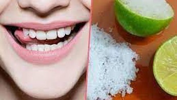 Làm trắng răng bằng muối và nước chanh liệu có hại?
