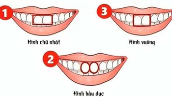Hình dạng răng cửa nói gì về bạn?