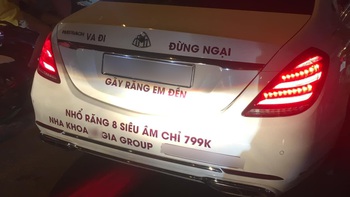 Ảnh vui 11-5: Va đi đừng... ngại, gãy răng em đền!