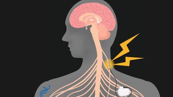 Giấc mơ dùng điện thay thế thuốc