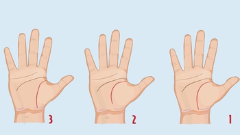 Quiz: Đường chỉ tay tiết lộ sức khỏe của bạn?