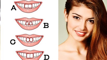 Quiz: Nhìn răng cửa biết ngay bạn thuộc tuýp người nào