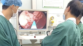 Người đàn ông đi ngoài phân đen, máu chảy thành tia trong dạ dày