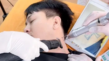 Hoài Lâm xóa sạch hình xăm