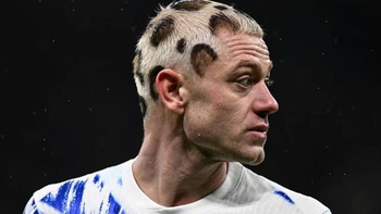 Ngôi sao người Na Uy gây sốc với kiểu tóc quái dị