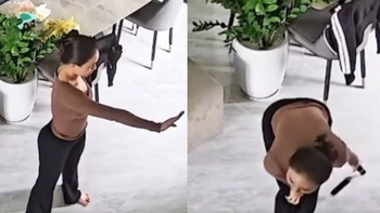 Cô gái sưng đầu gối khi thử múa côn