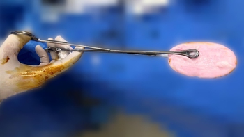 Bác sĩ cảnh báo xu hướng đáng lo gia tăng ở nhóm trẻ gái 10-16 tuổi