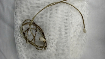 Nam sinh phải mổ khẩn vì dây sạc điện thoại trong bàng quang sau khi bắt chước clip trên mạng