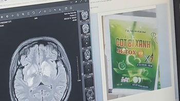 Uống 'cốt bí xanh detox' giảm cân, cô gái tổn thương não, suy thận