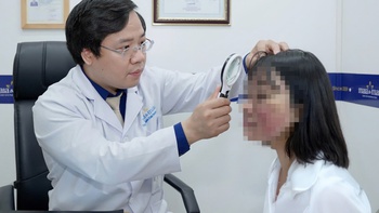 Dùng kem trị mụn ‘thuần tự nhiên’ trên TikTok, da mặt sưng đỏ, dị ứng nặng