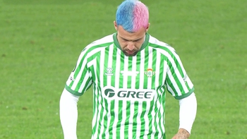 Sao Real Betis nhuộm tóc độc lạ lấy hên nhưng cái kết lại… đắng