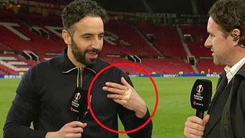 HLV Amorim của Man Utd bị thương bàn tay vì thói quen khó bỏ