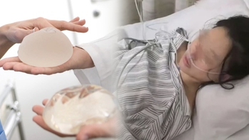 Sống sót nhờ túi nâng ngực... đỡ