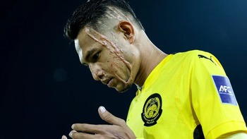 Cầu thủ Malaysia bị tạt axit sắp đấu với tuyển Việt Nam