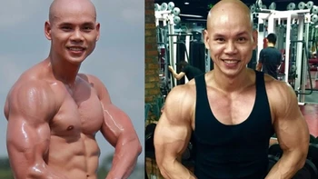 Nam ca sĩ mắc bệnh lạ khó mọc tóc, đi hát 22 năm vẫn bị nhầm tên