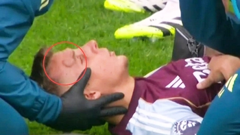 Hậu vệ Aston Villa u đầu vì va chạm với đồng đội Emiliano Martinez