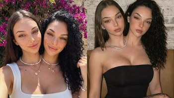 Cặp sinh đôi dính liền 'đánh lừa' hàng trăm ngàn người