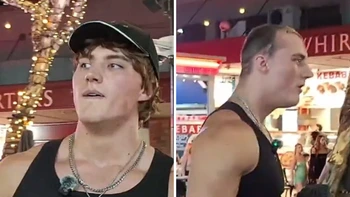 Sao mạng lộ đầu hói khi livestream hút hàng chục triệu lượt xem