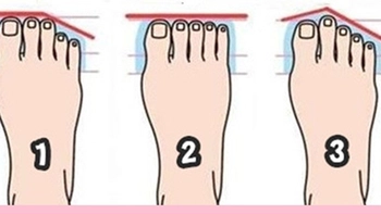 Hình dáng bàn chân tiết lộ thiên phú bẩm sinh của bạn