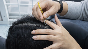 Nhổ tóc bạc cho 'đỡ ngứa mắt', coi chừng tóc không mọc lại