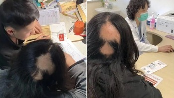 Mẹ hói cả đầu khi dạy con học