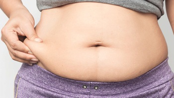 Béo phì không chỉ do 'ăn nhiều - ít vận động'