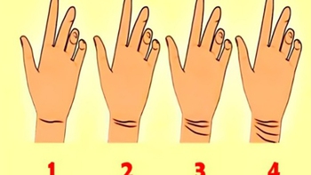 Quiz: Đường kẻ trên cổ tay tiết lộ bạn điềm báo gì?