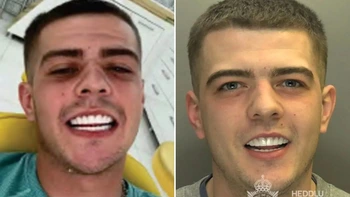 Tên tội phạm bị bắt vì khoe răng 'sáng như quảng cáo'