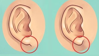Quiz: Hình dạng dái tai tiết lộ gì về tính cách của bạn?