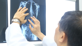 Nhiều trẻ vẹo cột sống nặng mới đi khám, chuyên gia cảnh báo nguy cơ biến chứng nặng