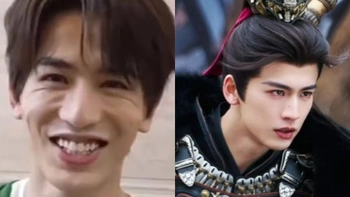 Bác sĩ thẩm mỹ giải mã nhan sắc của 'tướng quân kem nền' Trương Lăng Hách